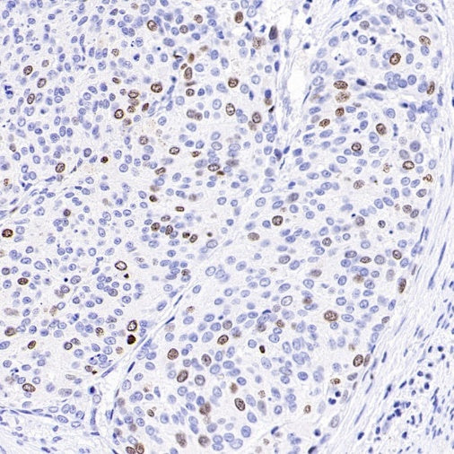 TOP2A Recombinant Rabbit mAb (S-513-107)