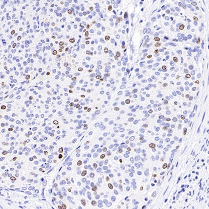 TOP2A Recombinant Rabbit mAb (S-513-107)