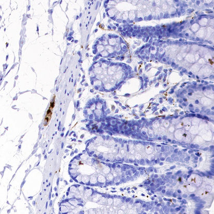 VIP Recombinant Rabbit mAb (S-1116-104)