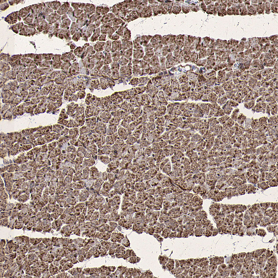 PDHE1 Alpha Mouse mAb