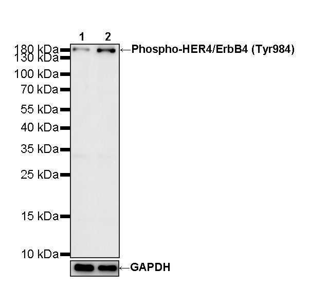 Phospho-HER4/ErbB4 (Tyr984) Recombinant Rabbit mAb (S-3502-53)