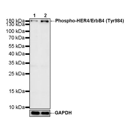Phospho-HER4/ErbB4 (Tyr984) Recombinant Rabbit mAb (S-3502-53)
