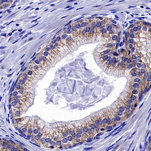 ATP7A Recombinant Rabbit mAb (S-2289-106)
