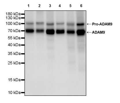 ADAM9 Recombinant Rabbit mAb (S-3270-74)