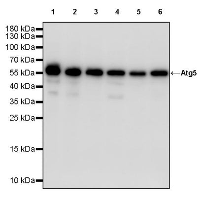Atg5 Recombinant Rabbit mAb (S-3181)