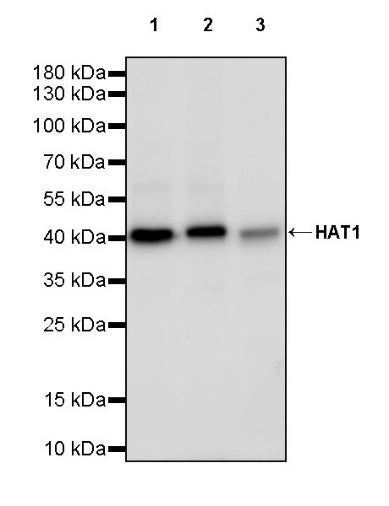HAT1 Recombinant Rabbit mAb (S-2429-14)