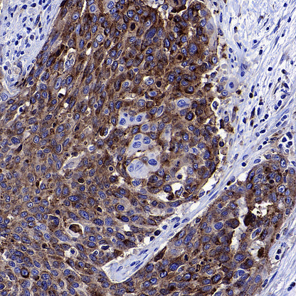 Transferrin Receptor Recombinant Rabbit mAb (S-4791)