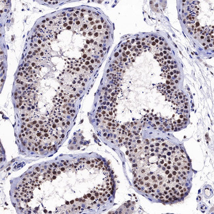 EWSR1/EWS Recombinant Rat mAb (S-R201)