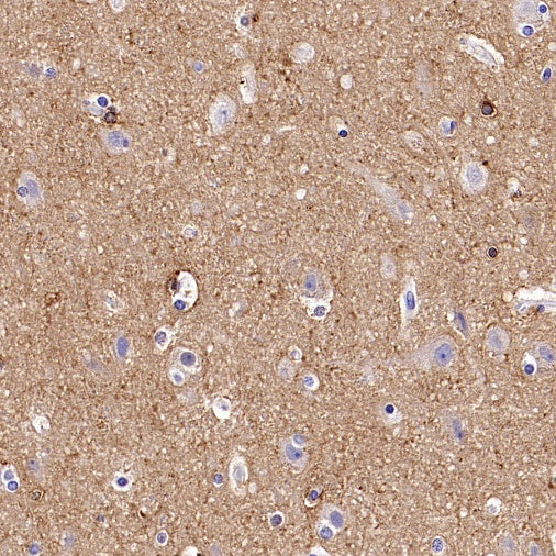 MARCKS Recombinant Rabbit mAb (S-3190-72)