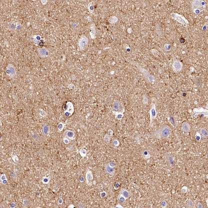 MARCKS Recombinant Rabbit mAb (S-3190-72)