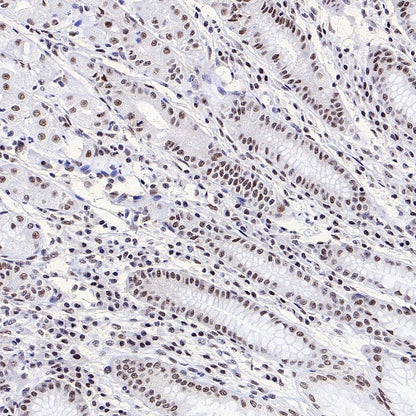 SF2 Recombinant Rabbit mAb (S-1845-27)