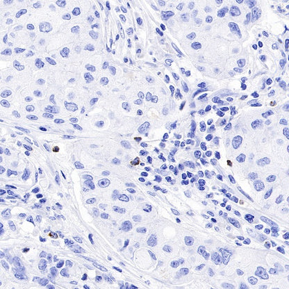 Granzyme B Recombinant Rabbit mAb (S-357-54)