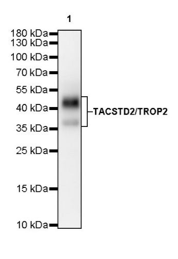 TACSTD2/TROP2 Recombinant Rabbit mAb (S-R237)