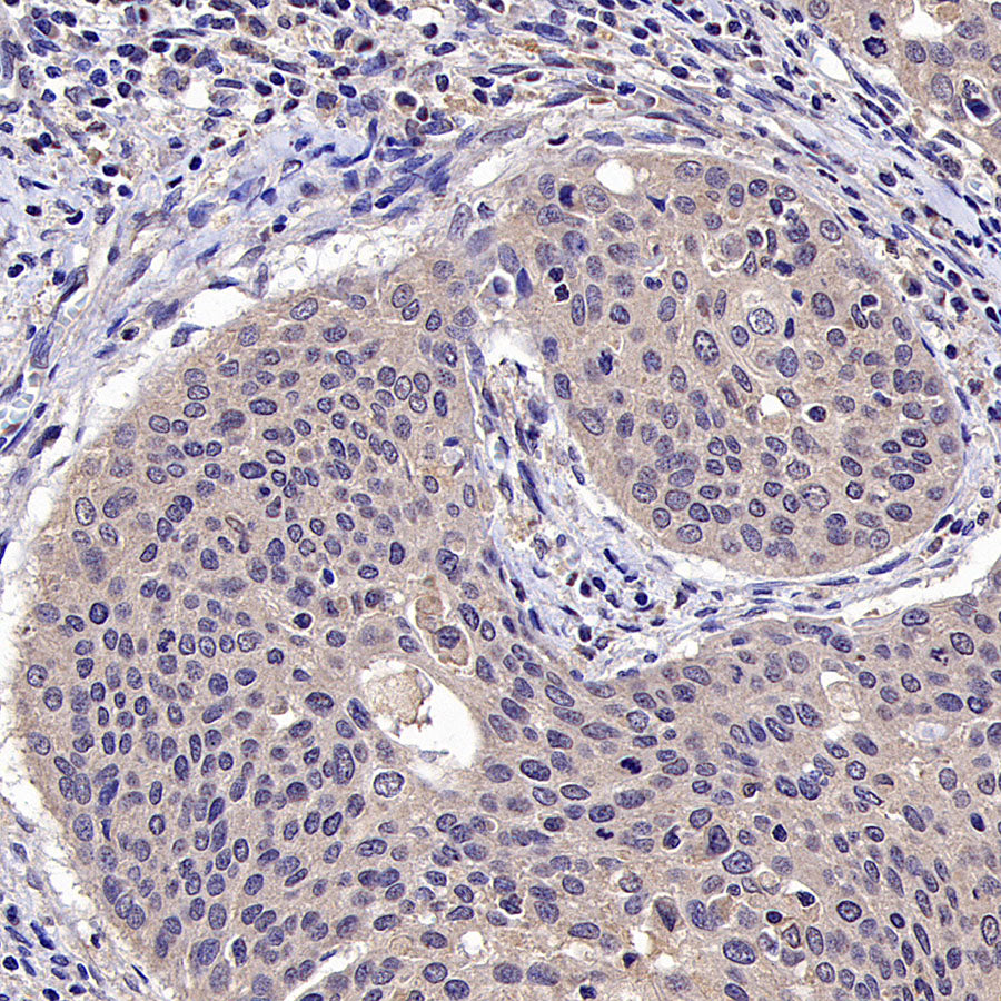 HLA Class I-A Recombinant Mouse mAb (S-3834)