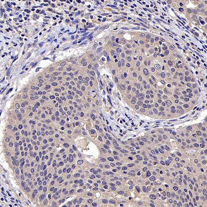 HLA Class I-A Recombinant Mouse mAb (S-3834)
