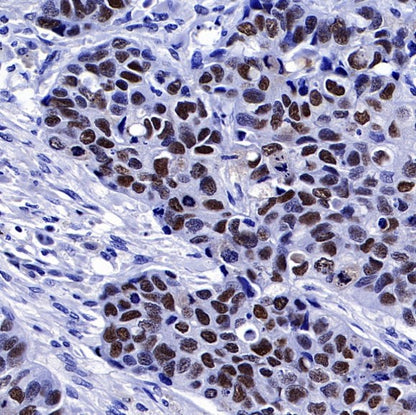 PES1 Recombinant Rat mAb (SDT-R197)