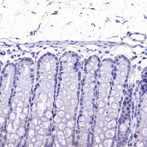 Olfm4 Recombinant Rabbit mAb (S-2748-67)