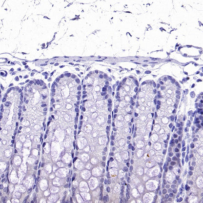 Olfm4 Recombinant Rabbit mAb (S-2748-67)