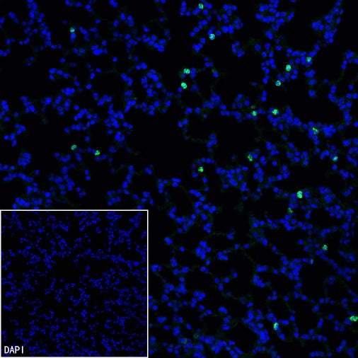 Lipocalin-2/NGAL Recombinant Rabbit mAb (S-2280-129)