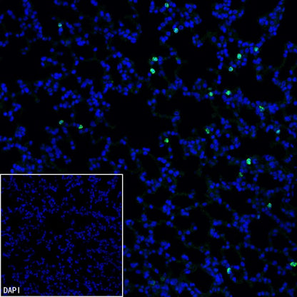 Lipocalin-2/NGAL Recombinant Rabbit mAb (S-2280-129)