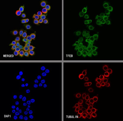 TFEB Recombinant Rabbit mAb,PBS Only (SDT-2411-7)