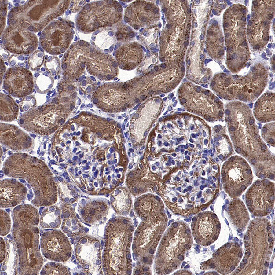 CYTB Recombinant Rabbit mAb (S-3877-15)