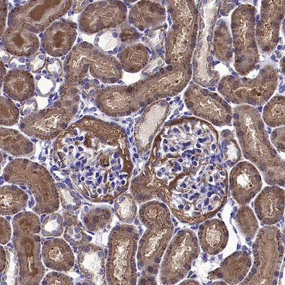 CYTB Recombinant Rabbit mAb (S-3877-15)