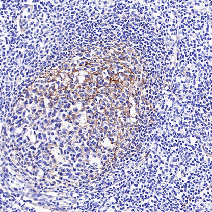 S-RMab®B7-H3/CD276 Recombinant Rabbit mAb (SDT-R158)