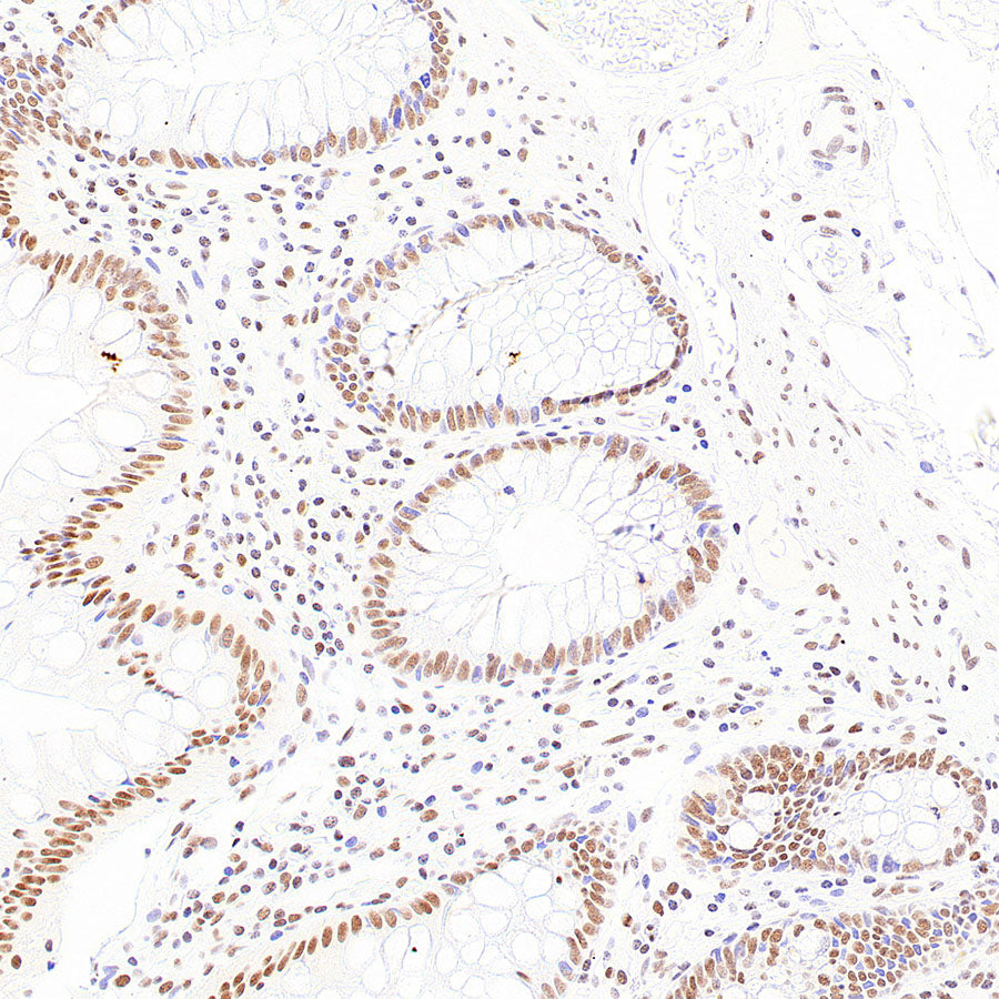 RAD21 Recombinant Rabbit mAb (S-4271-136)