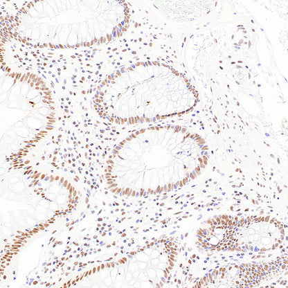 RAD21 Recombinant Rabbit mAb (S-4271-136)