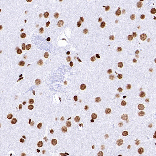 Histone H3 (acetyl K18) Recombinant Rabbit mAb (S-1688-90)
