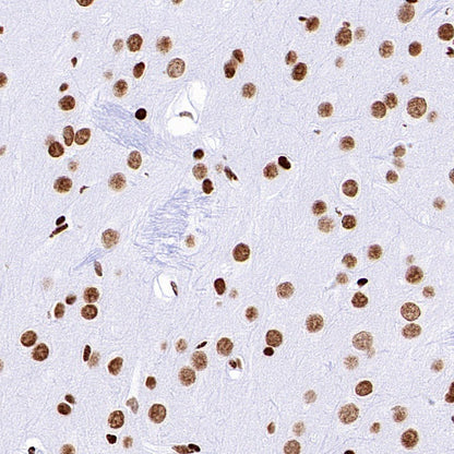 Histone H3 (acetyl K18) Recombinant Rabbit mAb (S-1688-90)