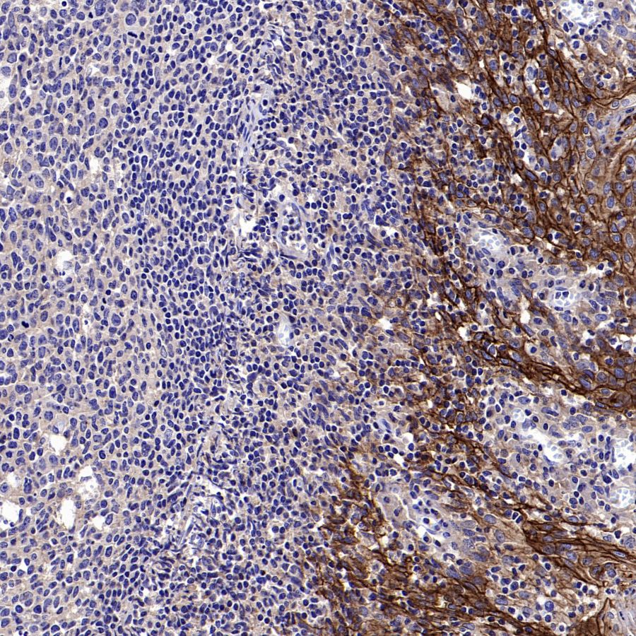 Desmocollin-2/3(DSC2/3) Recombinant Rabbit mAb (SDT-2102-59)