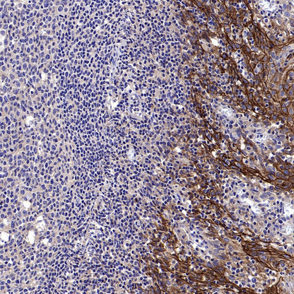 Desmocollin-2/3(DSC2/3) Recombinant Rabbit mAb (SDT-2102-59)