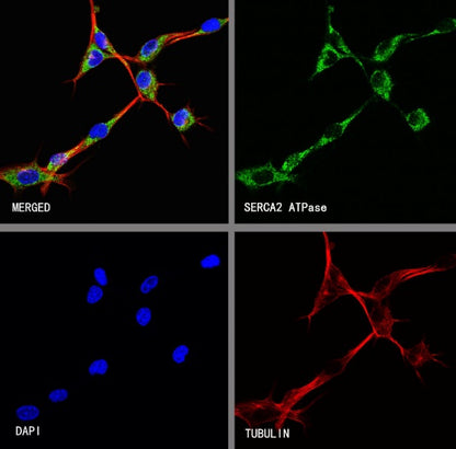 SERCA2 ATPase Recombinant Rabbit mAb (S-5956)