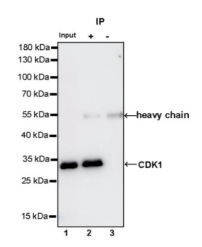 Cyclin D1 Recombinant Rabbit mAb (SDT-R423)