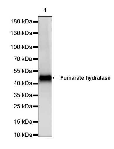 Fumarate hydratase Recombinant Rabbit mAb (SDT-2434-54)