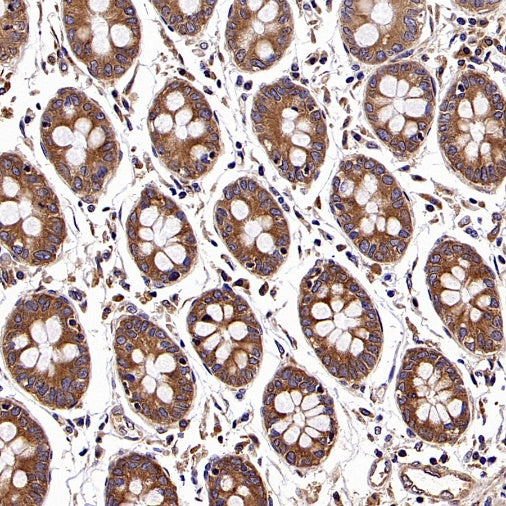 NMT1 Recombinant Rabbit mAb (S-2986-17)