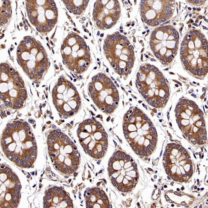 NMT1 Recombinant Rabbit mAb (S-2986-17)