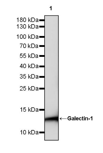 Galectin-1 Recombinant Rabbit mAb (S-1221-32）