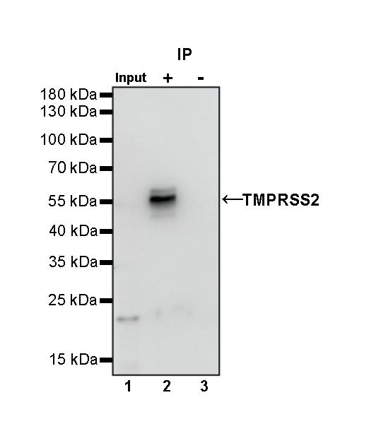 TMPRSS2 Recombinant Rabbit mAb (S-735-40)