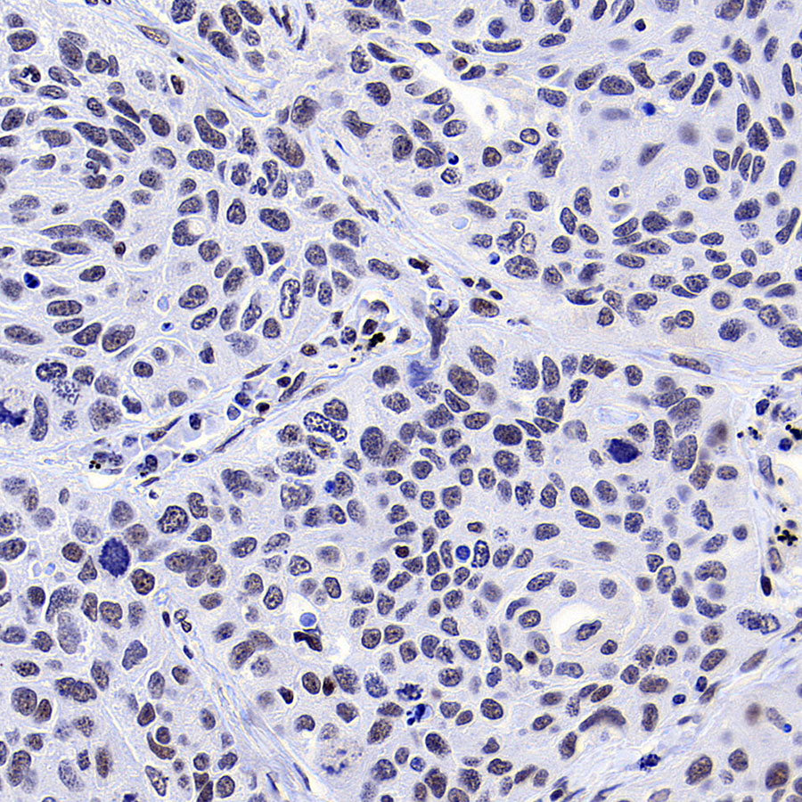 YY1 Recombinant Rabbit mAb (S-3652-44)