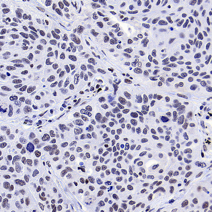 YY1 Recombinant Rabbit mAb (S-3652-44)
