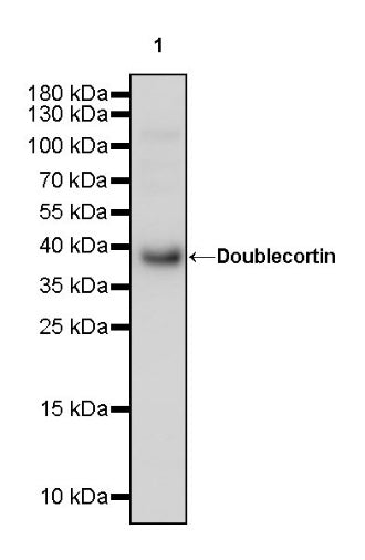 Doublecortin Recombinant Rabbit mAb (S-1234-3)
