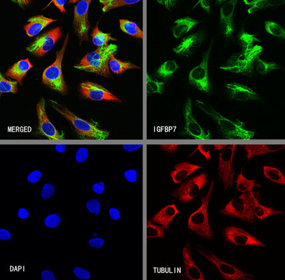 IGFBP7 Recombinant Rabbit mAb (S-3091-44)