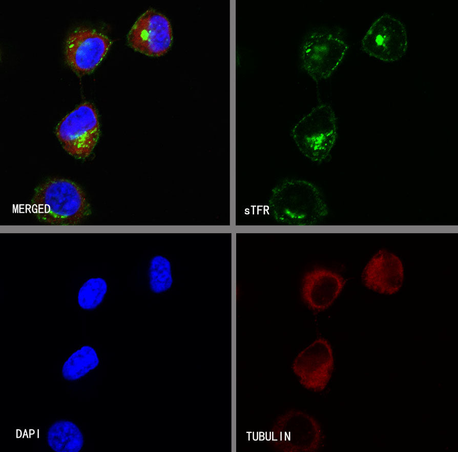 sTfR Recombinant Rabbit mAb (S-612-12)