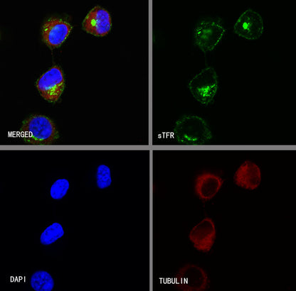 sTfR Recombinant Rabbit mAb (S-612-12)