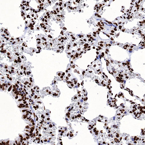 hnRNPK Recombinant Rabbit mAb (S-1645-45)