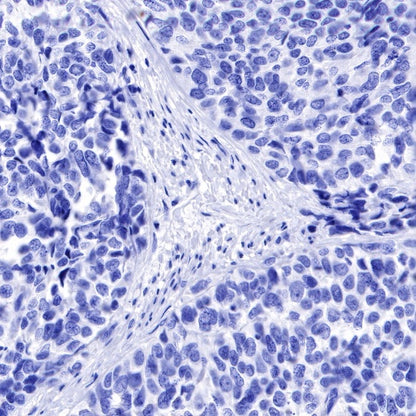 GLP-1 (active) Recombinant Rabbit mAb (S-R280)