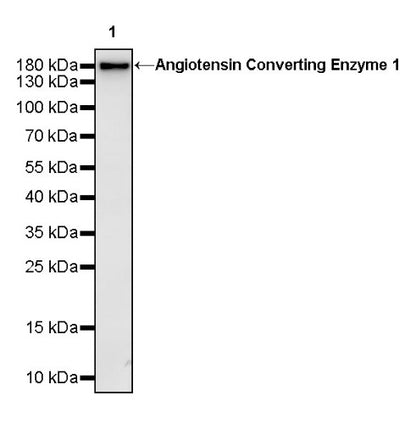 Angiotensin Converting Enzyme 1 Recombinant Rabbit mAb (SDT-2662-122)